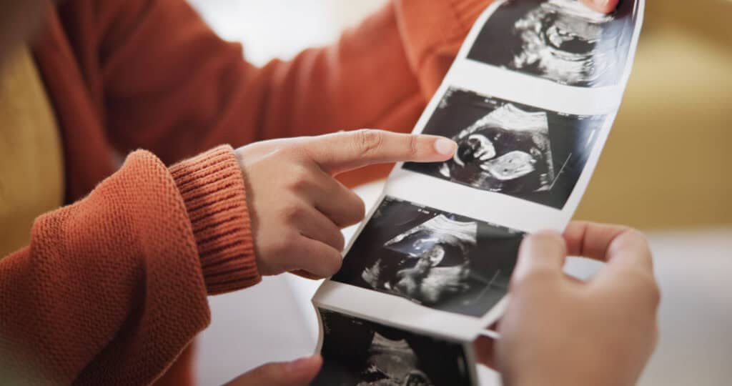 Werdende Eltern betrachten Ultraschallbilder – Autismus und Schwangerschaft